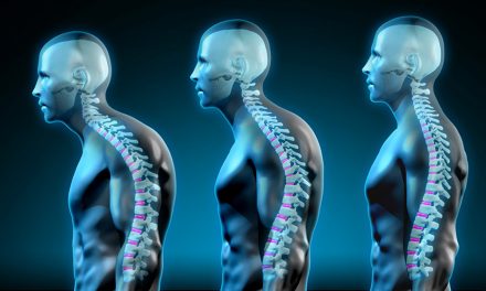 The 3 best ways to improve your posture